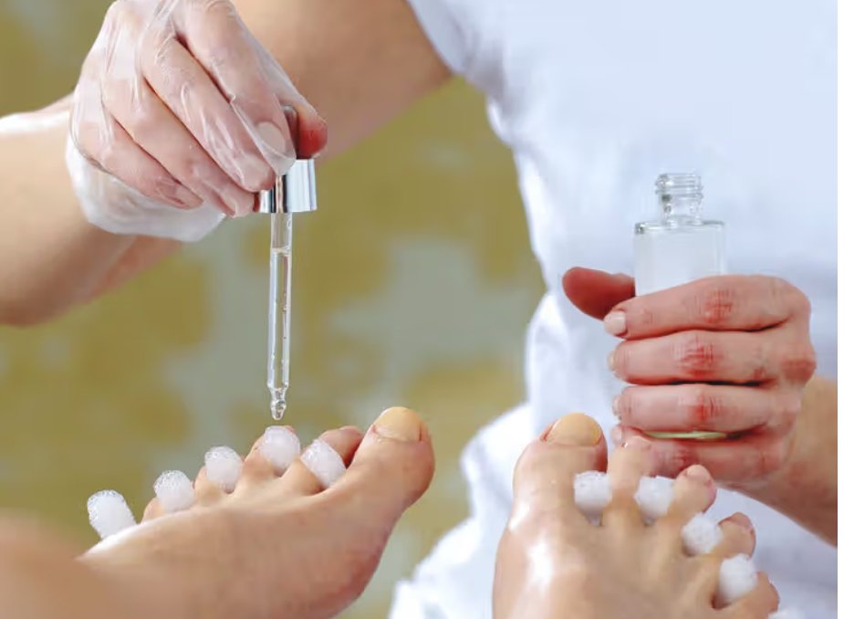 How to Choose the Right Essential Oil for Nail Fungus