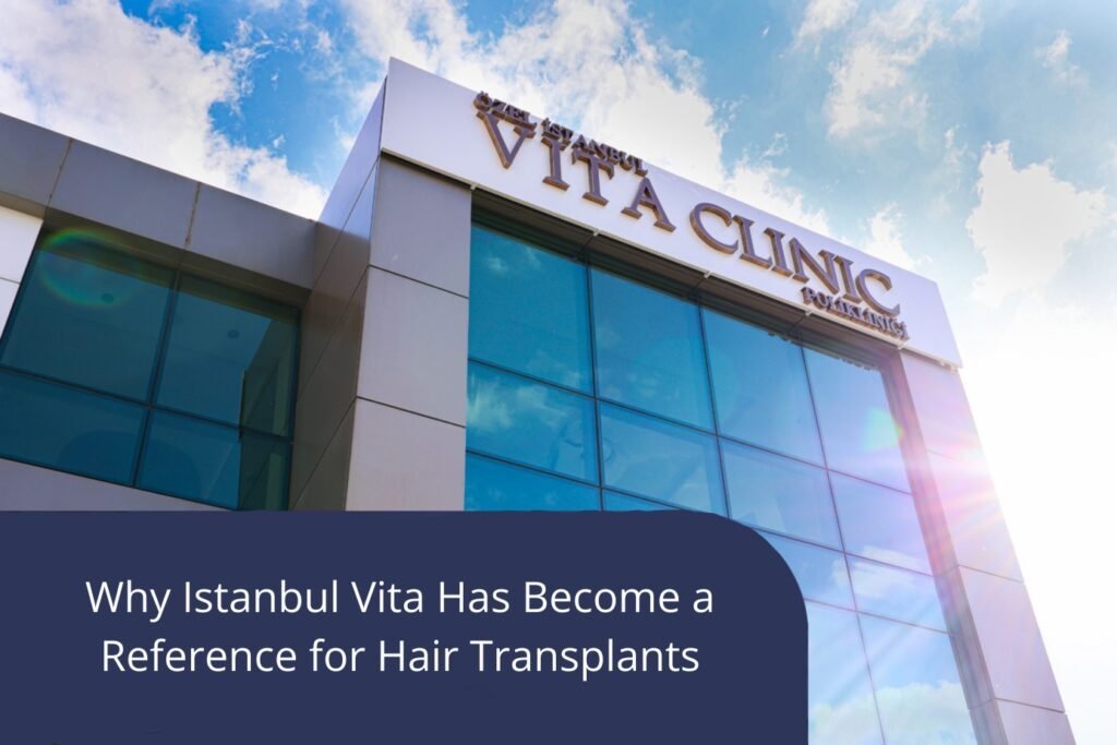 Why istanbul vita Has Become a Reference for Hair Transplants